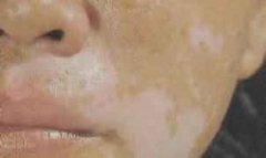 ļưɫЧ